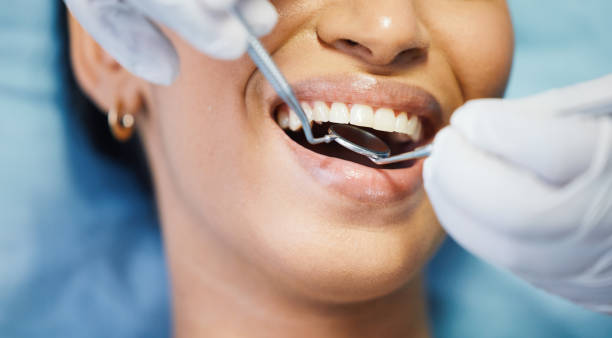 Best Root Canal Emergency Dentist  in Maryville, MO