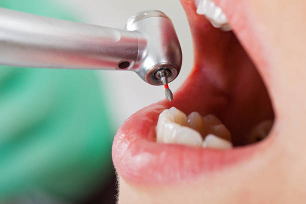 Best Tooth Infection Emergency Dentist  in Maryville, MO